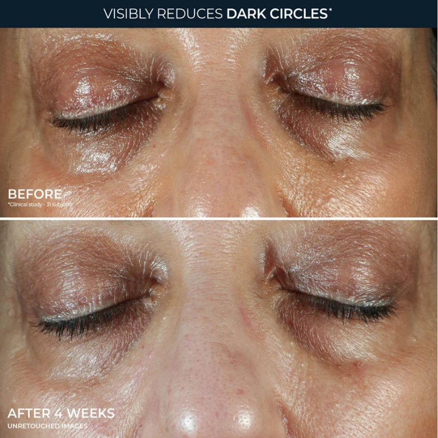 RoC Multi Correxion Even Tone + Lift Eye Cream