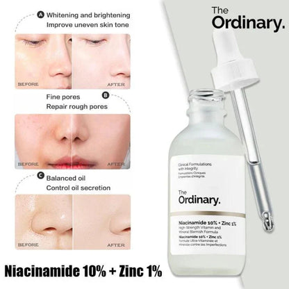 The Ordinary Niacinamide 10% + Zinc 1% Serum