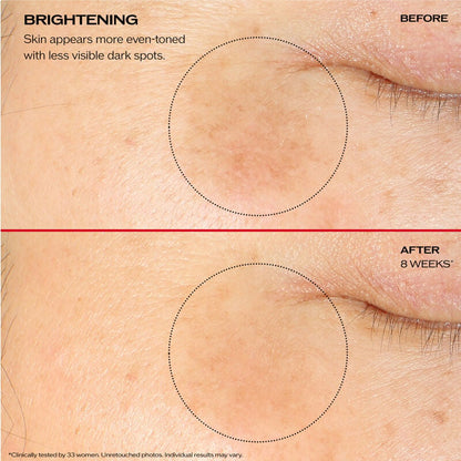 SHISEIDO-Vital Perfection Uplifting and Firming Advanced Cream 15 ml