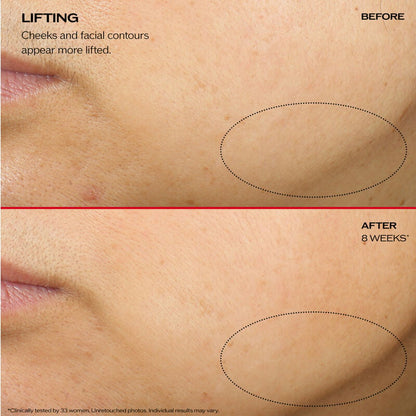 SHISEIDO-Vital Perfection Uplifting and Firming Advanced Cream 15 ml