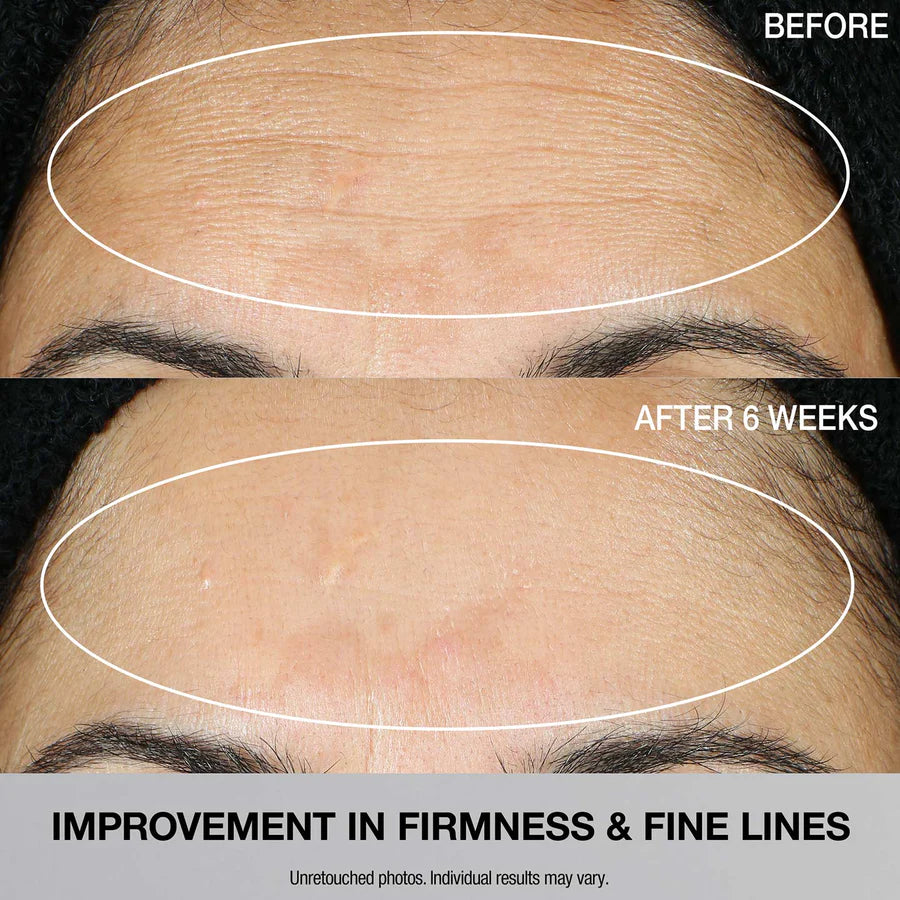 StriVectin Multi Action Super C Retinol Brightening Serum