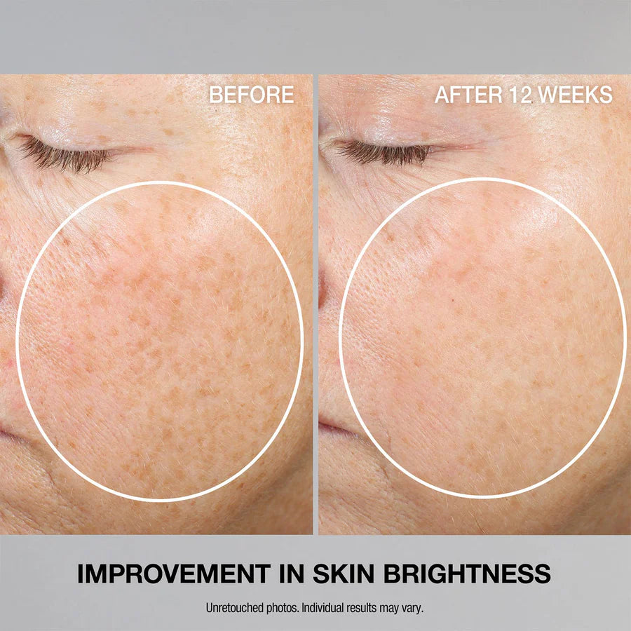 StriVectin Multi Action Super C Retinol Brightening Serum