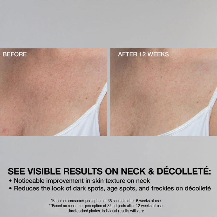 StriVectin Multi Action Super C Retinol Brightening Serum