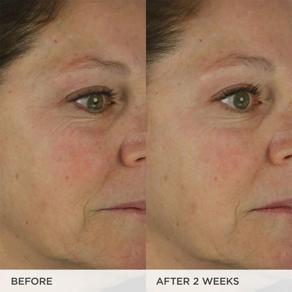 The Dewy Skin Cream Rich Line-Plumping Moisturizer (Refill Pod)