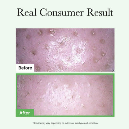 Arencia Pore Melt Mochi Cleansing Oil