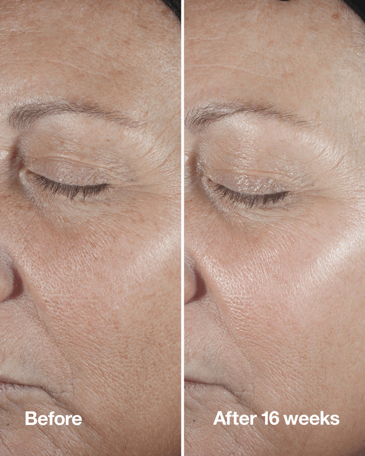 Clinique Smart Clinical Repair Wrinkle Correcting Serum