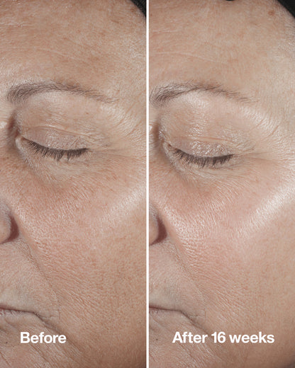 Clinique Smart Clinical Repair Wrinkle Correcting Serum