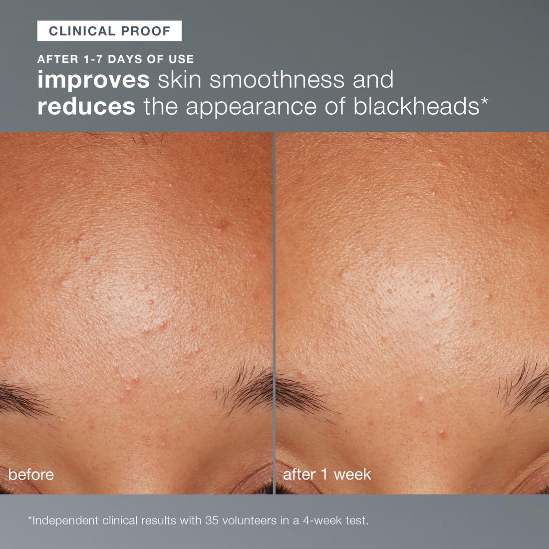 Dermalogica Daily Microfoliant Brightening Powder Exfoliant