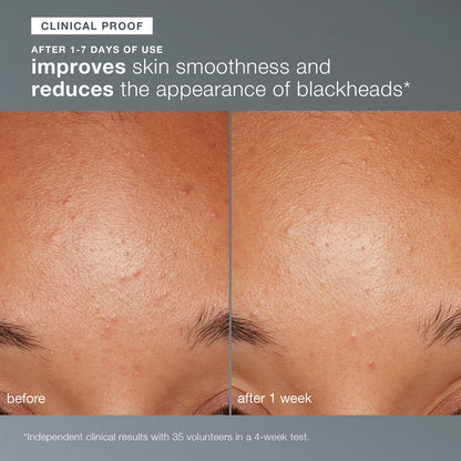 Dermalogica Daily Microfoliant Brightening Powder Exfoliant