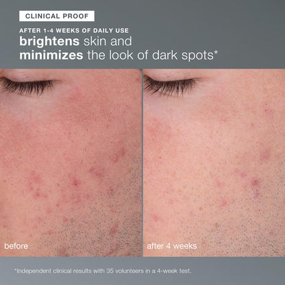 Dermalogica Daily Microfoliant Brightening Powder Exfoliant