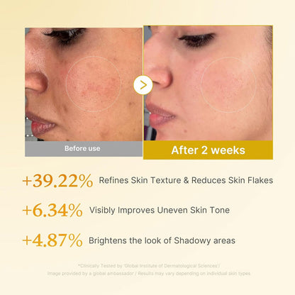 Medicube Kojic Acid Turmeric Resurfacing Toner