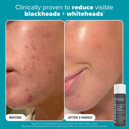 Paula's Choice Exfoliation Icons Kit