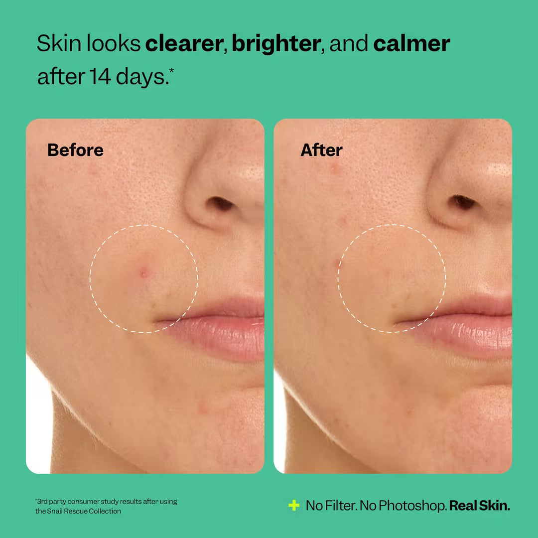 Peach & Lily Peach Slices Snail Rescue Purifying Cleanser