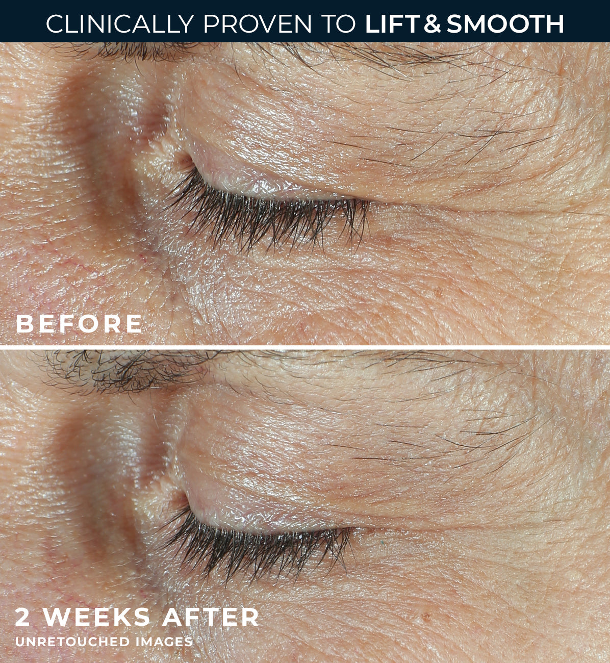RoC Derm Correxion Dual Eye Cream