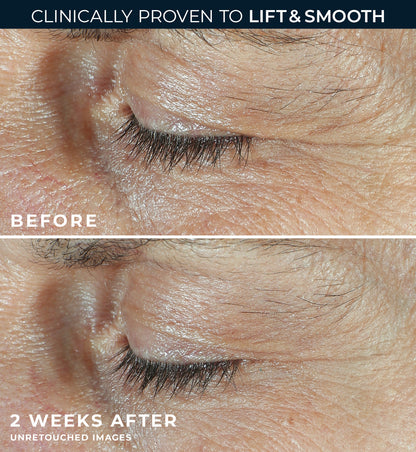 RoC Derm Correxion Dual Eye Cream