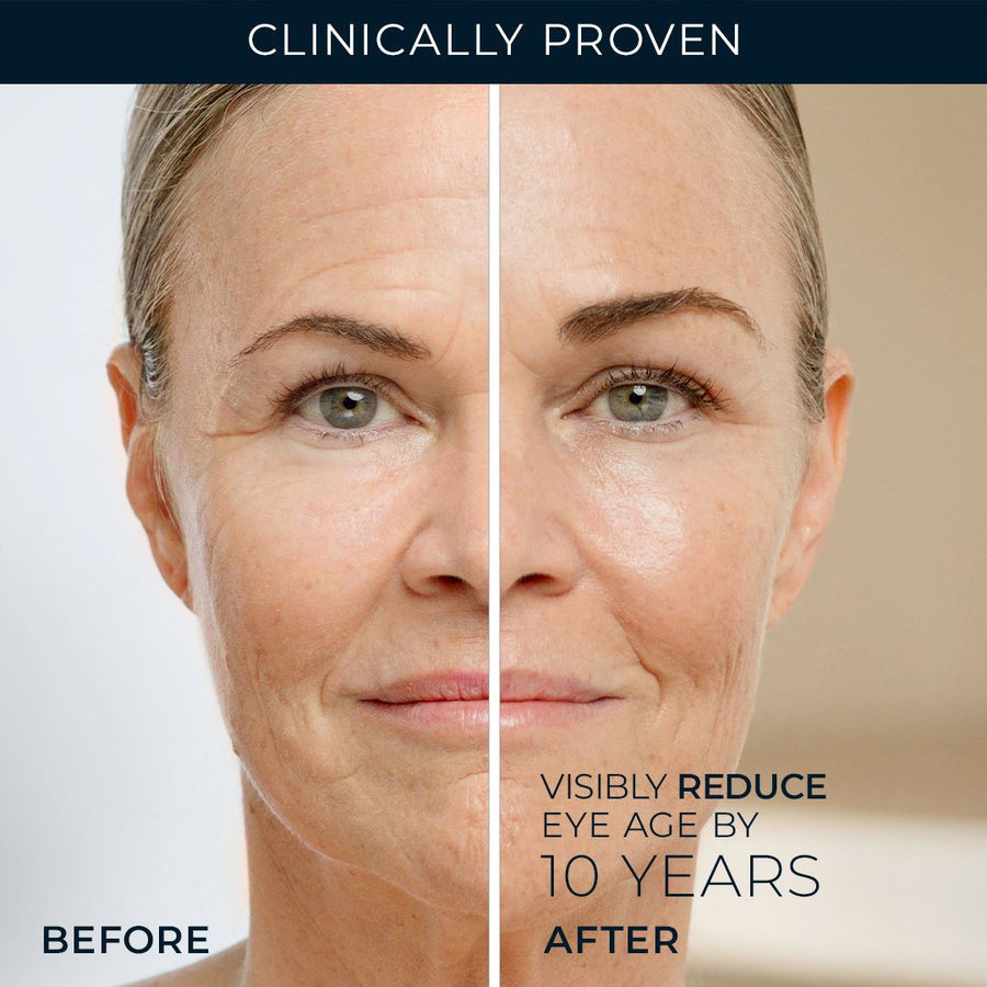 RoC Retinol Correxion Line Smoothing Eye Cream