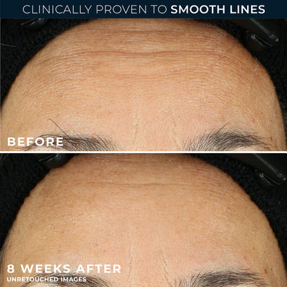 RoC Retinol Correxion Line Smoothing Night Serum Capsules