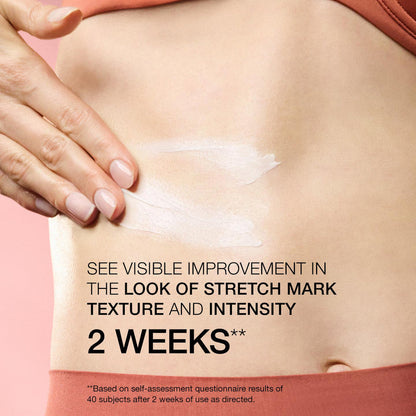 StriVectin SD Advanced Plus Intensive Moisturizing Concentrate