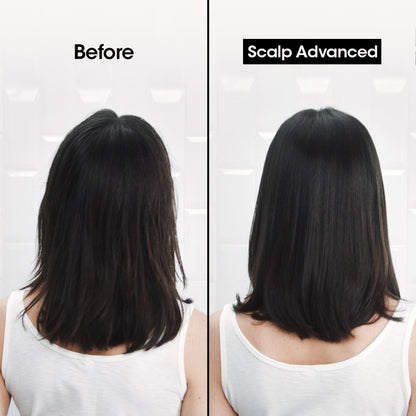 L'Oreal Professionnel Scalp Advance Anti-Dandruff Shampoo