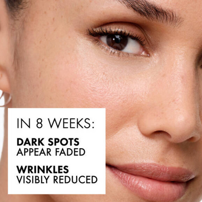 Vichy | LiftActiv B3 Serum for Dark Spots & Wrinkles