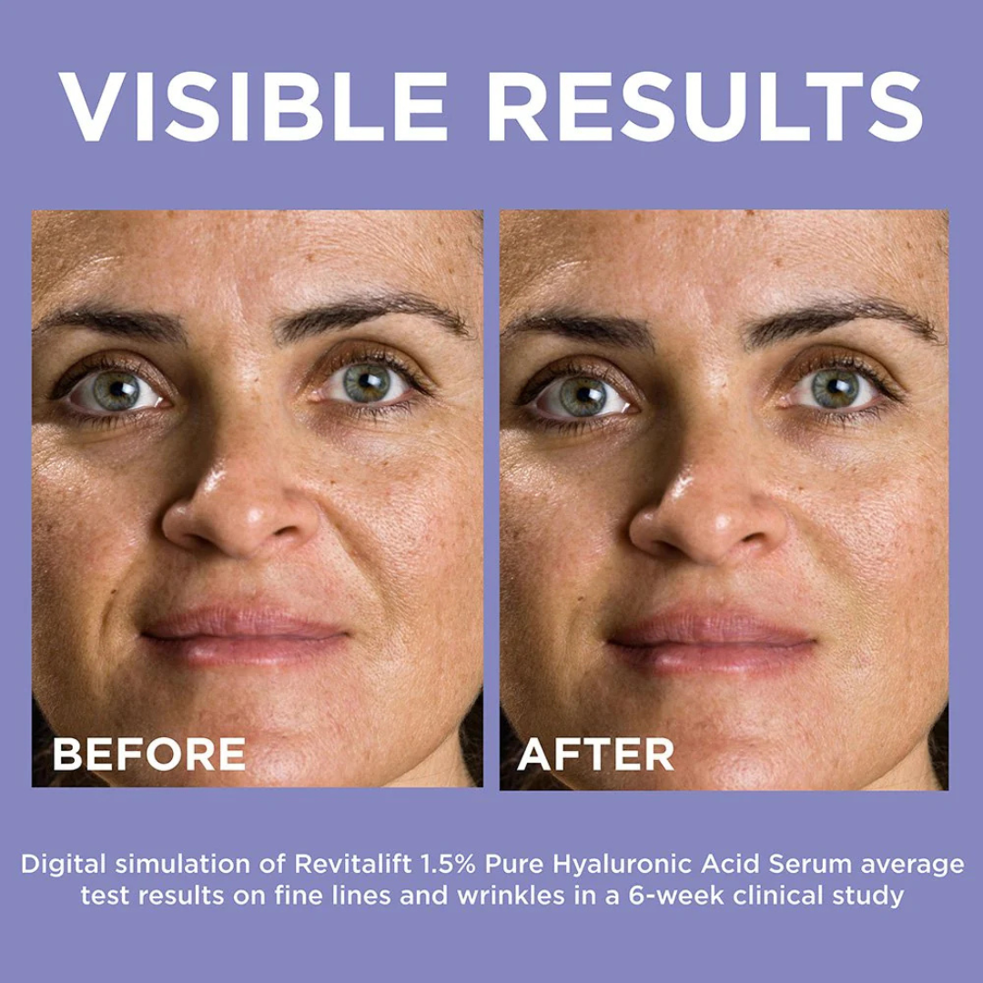 Loreal Paris | Revitalift Derm Intensives 1.5% Pure Hyaluronic Acid Serum