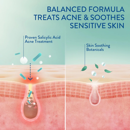 Cetaphil | Gentle Clear | Matte Acne Moisturizer | Salicylic Acid Acne Treatment