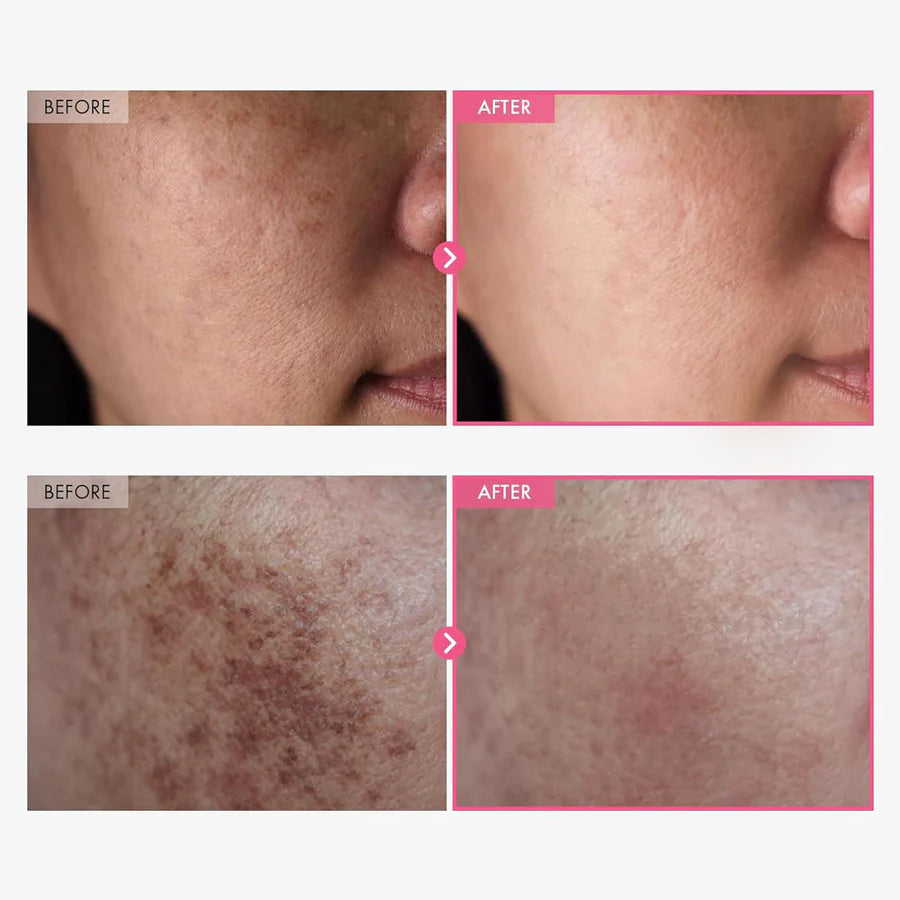 Tosowoong Arbutin 5 Whitening Cream