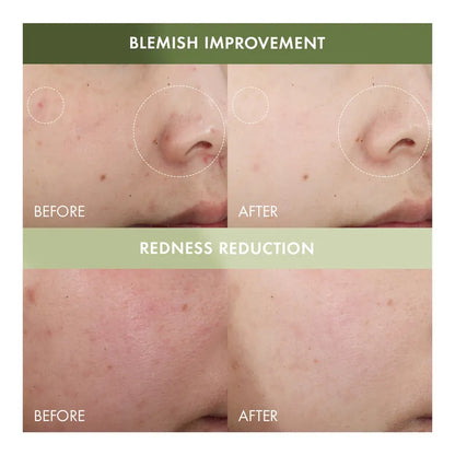 Origins Mega-Mushroom Relief & Resilience Soothing Treatment Lotion