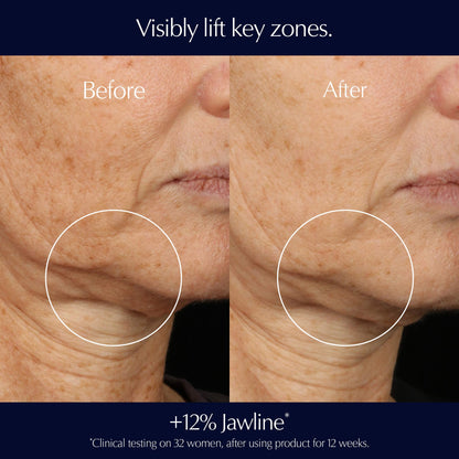 Estée Lauder Perfectionist Pro Rapid Firm + Lift Serum with Hexapeptides-8 (15 ml)